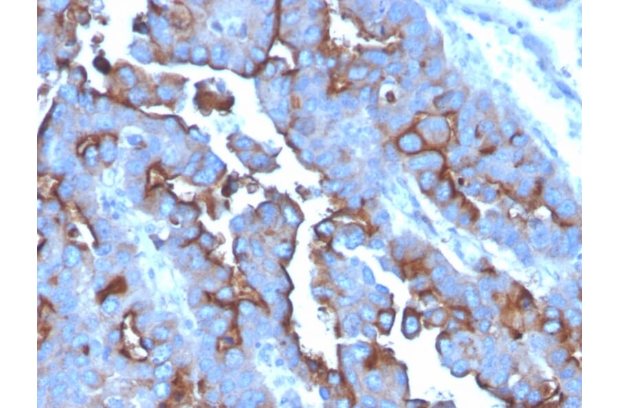 Immunohistochemistry - Anti-Transferrin Receptor Antibody [TFRC/3630] - BSA and Azide free (A253270) - Antibodies.com