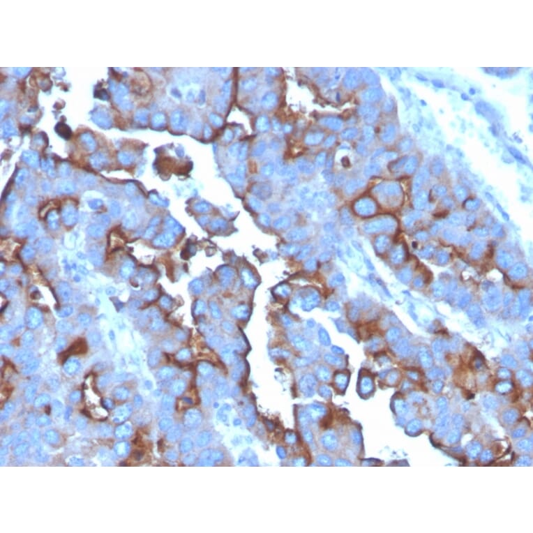 Immunohistochemistry - Anti-Transferrin Receptor Antibody [TFRC/3630] - BSA and Azide free (A253270) - Antibodies.com