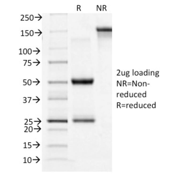 SDS-PAGE - Anti-Transferrin Receptor Antibody [TFRC/1396] - BSA and Azide free (A253276) - Antibodies.com