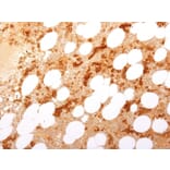 Immunohistochemistry - Anti-Transferrin Receptor Antibody [TFRC/1817] - BSA and Azide free (A253276) - Antibodies.com