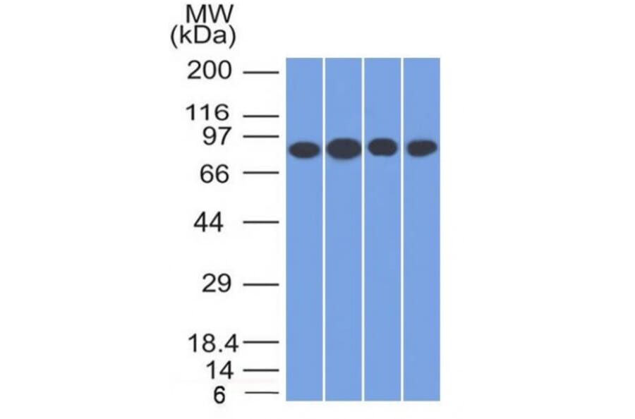 Western Blot - Anti-Transferrin Receptor Antibody [TFRC/1817] - BSA and Azide free (A253277) - Antibodies.com