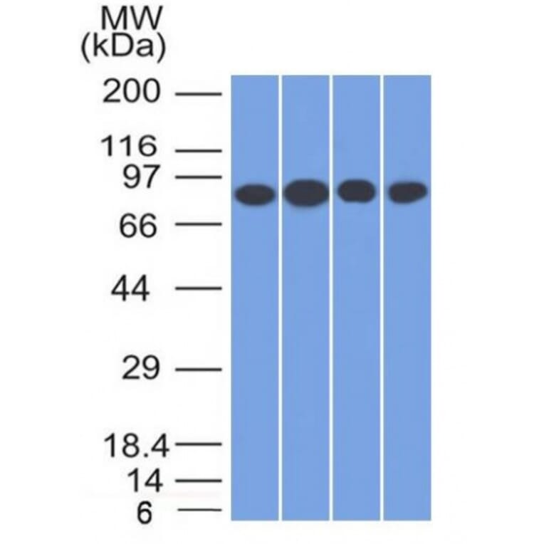 Western Blot - Anti-Transferrin Receptor Antibody [TFRC/1817] - BSA and Azide free (A253277) - Antibodies.com