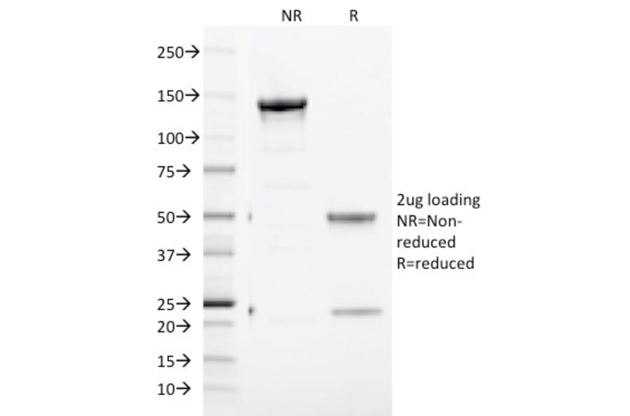 SDS-PAGE - Anti-Transferrin Receptor Antibody [TFRC/1817] - BSA and Azide free (A253277) - Antibodies.com