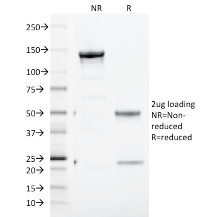SDS-PAGE - Anti-Transferrin Receptor Antibody [TFRC/1817] - BSA and Azide free (A253277) - Antibodies.com