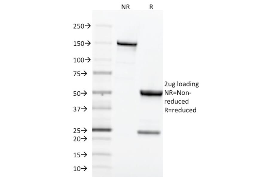 SDS-PAGE - Anti-Transferrin Receptor Antibody [TFRC/1818] - BSA and Azide free (A253278) - Antibodies.com