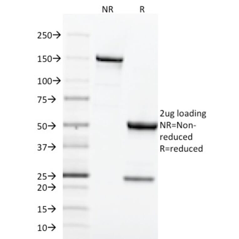 SDS-PAGE - Anti-Transferrin Receptor Antibody [TFRC/1818] - BSA and Azide free (A253278) - Antibodies.com