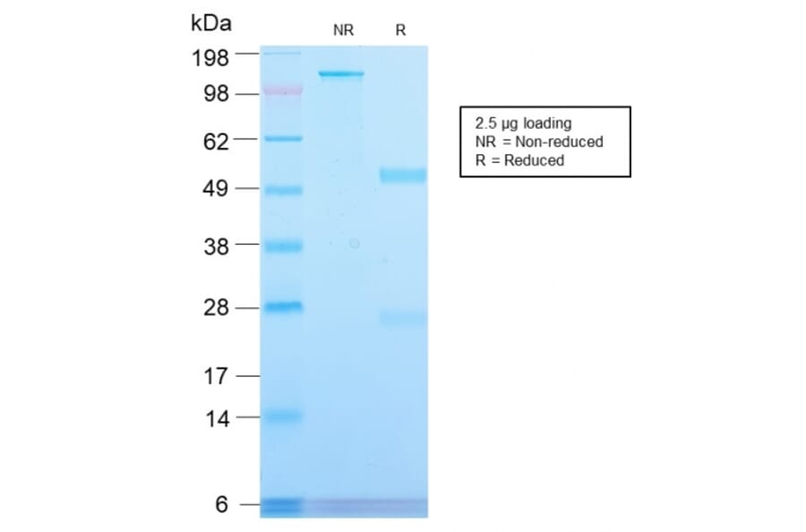 SDS-PAGE - Anti-Transferrin Receptor Antibody [TFRC/2898R] - BSA and Azide free (A253280) - Antibodies.com