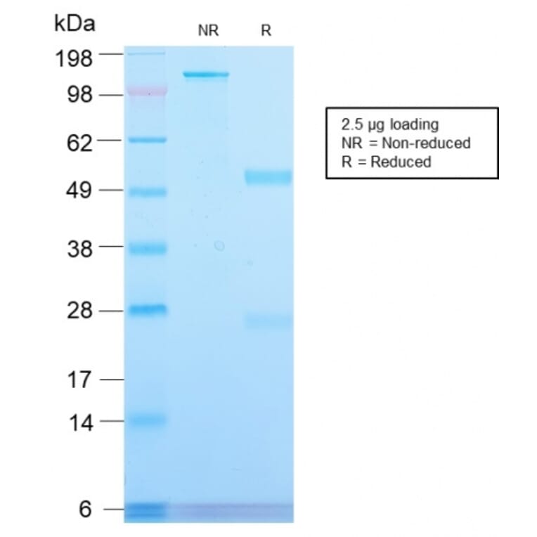 SDS-PAGE - Anti-Transferrin Receptor Antibody [TFRC/2898R] - BSA and Azide free (A253280) - Antibodies.com