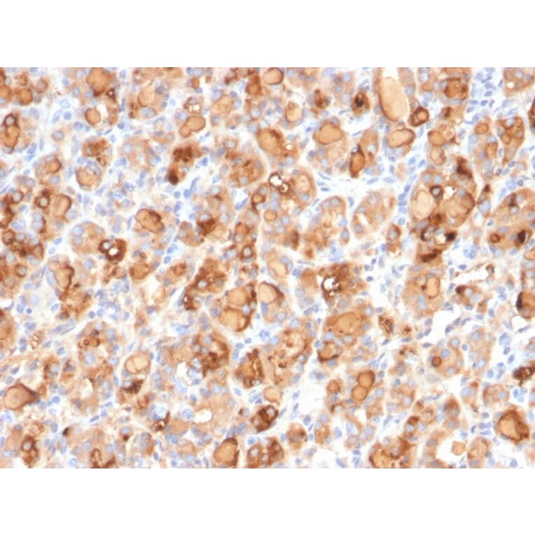 Immunohistochemistry - Anti-Thyroglobulin Antibody [r2H11] - BSA and Azide free (A253281) - Antibodies.com