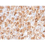 Immunohistochemistry - Anti-Thyroglobulin Antibody [r2H11] - BSA and Azide free (A253281) - Antibodies.com