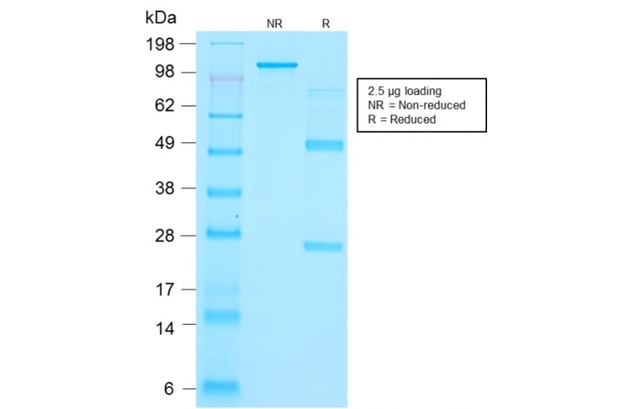 SDS-PAGE - Anti-Thyroglobulin Antibody [r2H11] - BSA and Azide free (A253281) - Antibodies.com