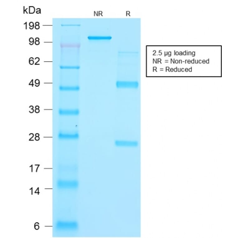 SDS-PAGE - Anti-Thyroglobulin Antibody [r2H11] - BSA and Azide free (A253281) - Antibodies.com