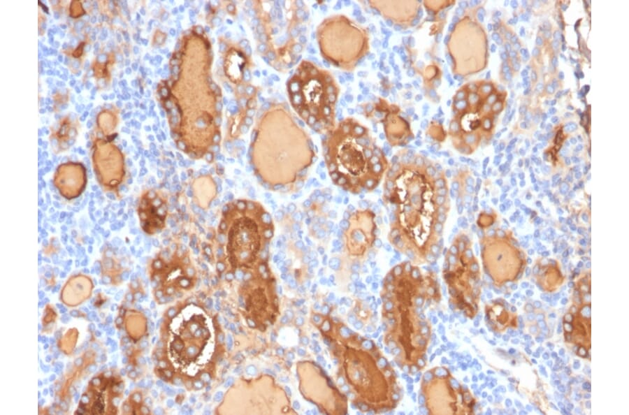 Immunohistochemistry - Anti-Thyroglobulin Antibody [r2H11] - BSA and Azide free (A253280) - Antibodies.com