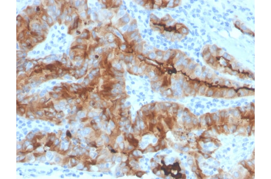 Immunohistochemistry - Anti-Thyroglobulin Antibody [rTGB/4744] - BSA and Azide free (A253281) - Antibodies.com