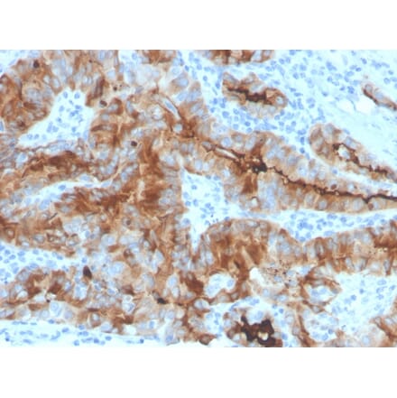 Immunohistochemistry - Anti-Thyroglobulin Antibody [rTGB/4744] - BSA and Azide free (A253281) - Antibodies.com