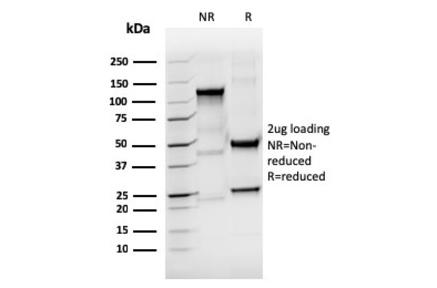 SDS-PAGE - Anti-Thyroglobulin Antibody [rTGB/4744] - BSA and Azide free (A253282) - Antibodies.com