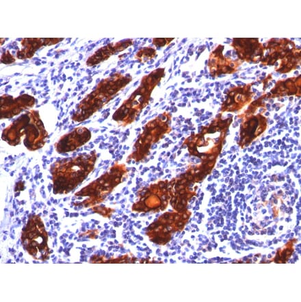 Immunohistochemistry - Anti-Thyroglobulin Antibody [2H11] - BSA and Azide free (A253282) - Antibodies.com
