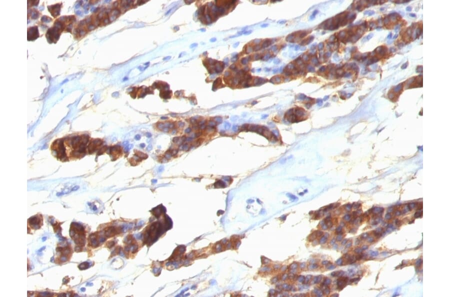 Immunohistochemistry - Anti-Thyroglobulin Antibody [SPM221] - BSA and Azide free (A253283) - Antibodies.com