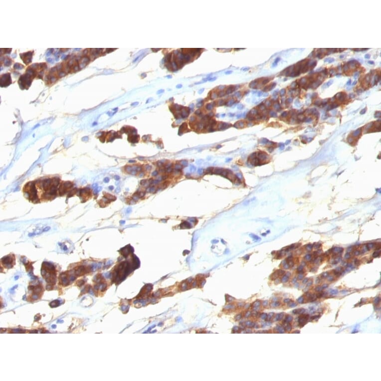 Immunohistochemistry - Anti-Thyroglobulin Antibody [SPM221] - BSA and Azide free (A253283) - Antibodies.com