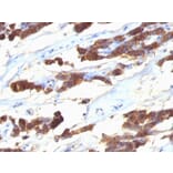 Immunohistochemistry - Anti-Thyroglobulin Antibody [SPM221] - BSA and Azide free (A253283) - Antibodies.com