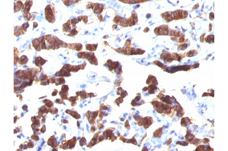 Immunohistochemistry - Anti-Thyroglobulin Antibody [TGB24] - BSA and Azide free (A253288) - Antibodies.com