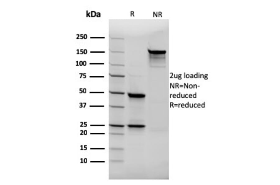 SDS-PAGE - Anti-Thyroglobulin Antibody [rTGB24] - BSA and Azide free (A253290) - Antibodies.com