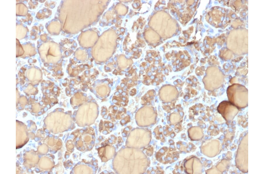 Immunohistochemistry - Anti-Thyroglobulin Antibody [r6E1] - BSA and Azide free (A253291) - Antibodies.com