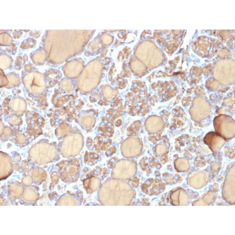 Immunohistochemistry - Anti-Thyroglobulin Antibody [r6E1] - BSA and Azide free (A253291) - Antibodies.com