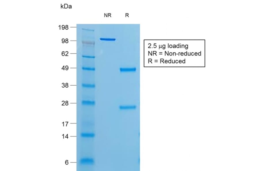 SDS-PAGE - Anti-Thyroglobulin Antibody [r6E1] - BSA and Azide free (A253291) - Antibodies.com