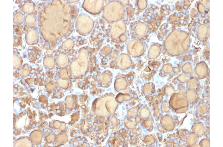 Immunohistochemistry - Anti-Thyroglobulin Antibody [r6E1] - BSA and Azide free (A253290) - Antibodies.com