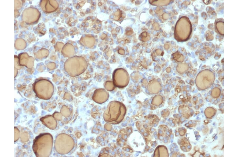 Immunohistochemistry - Anti-Thyroglobulin Antibody [TGB/1970R] - BSA and Azide free (A253291) - Antibodies.com