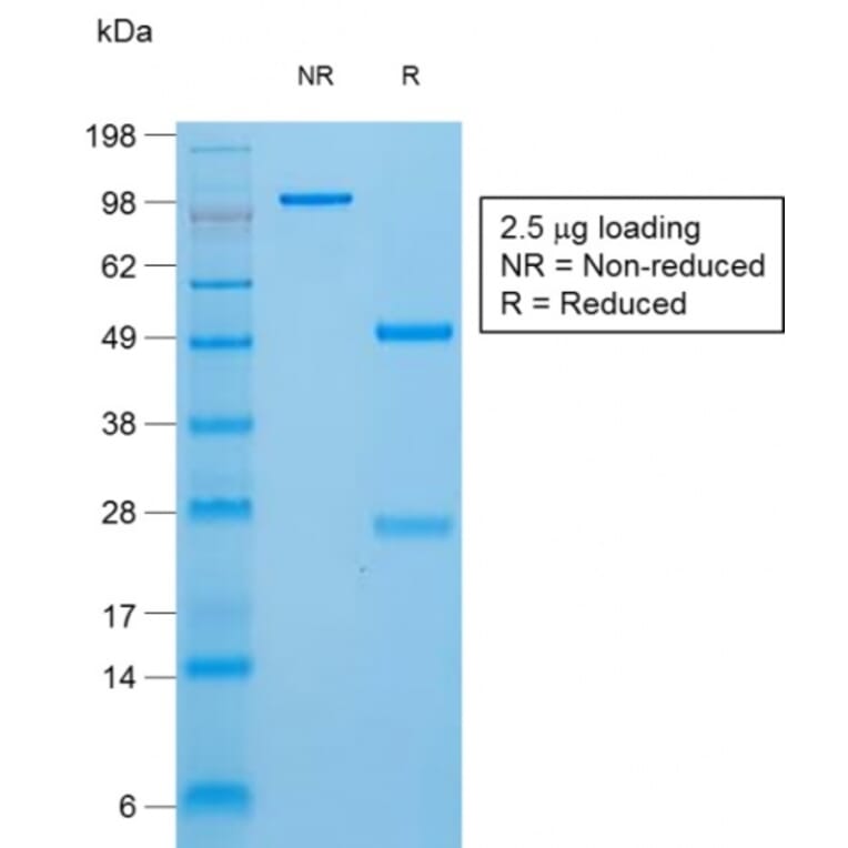 SDS-PAGE - Anti-Thyroglobulin Antibody [TGB/1970R] - BSA and Azide free (A253292) - Antibodies.com