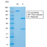 SDS-PAGE - Anti-Thyroglobulin Antibody [TGB/1970R] - BSA and Azide free (A253292) - Antibodies.com