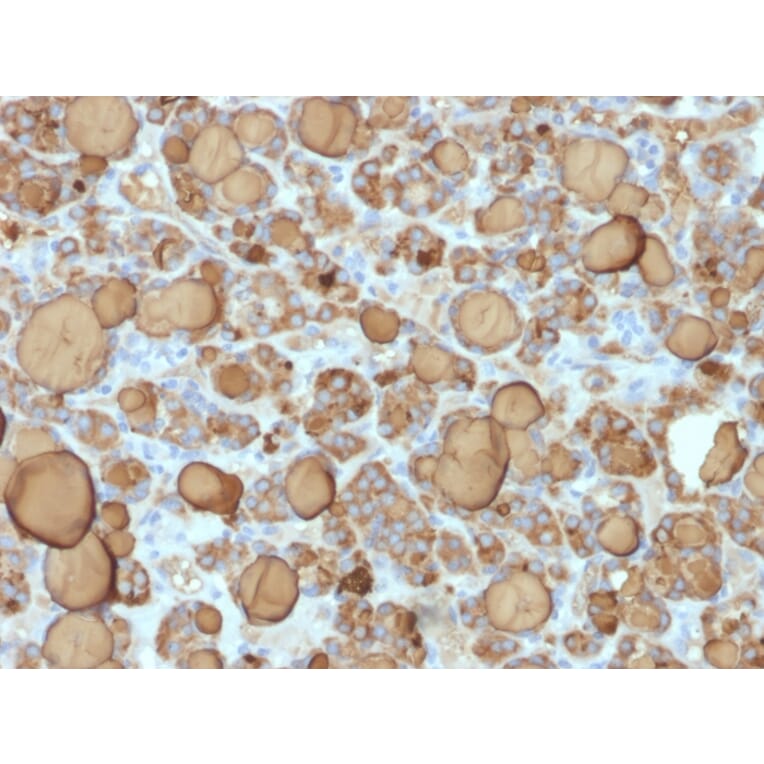 Immunohistochemistry - Anti-Thyroglobulin Antibody [TGB/1968R] - BSA and Azide free (A253292) - Antibodies.com