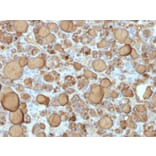 Immunohistochemistry - Anti-Thyroglobulin Antibody [TGB/1968R] - BSA and Azide free (A253292) - Antibodies.com