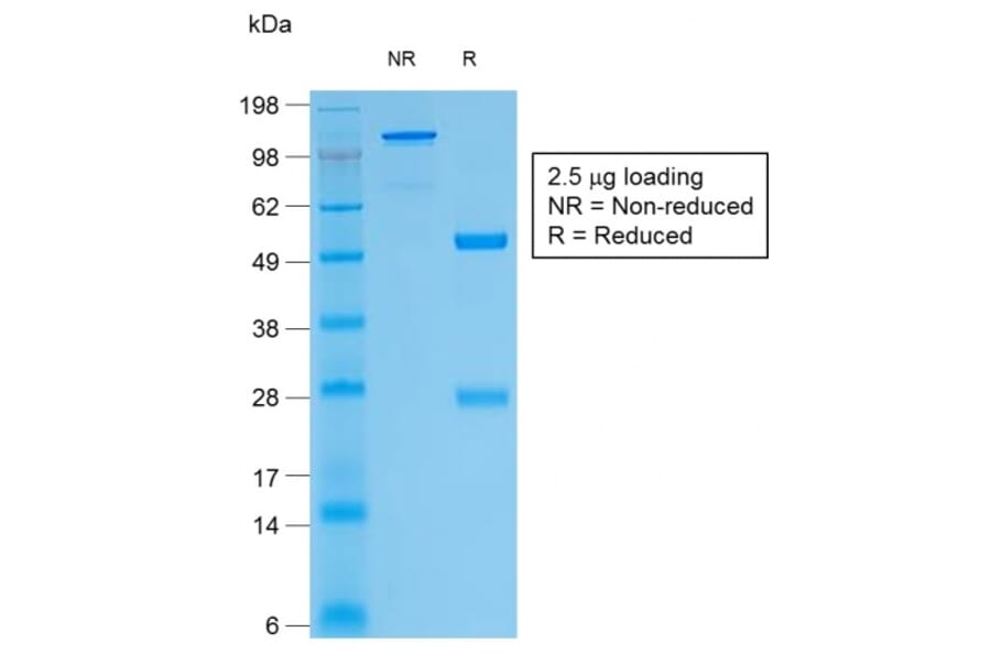 SDS-PAGE - Anti-Thyroglobulin Antibody [TGB/1968R] - BSA and Azide free (A253293) - Antibodies.com