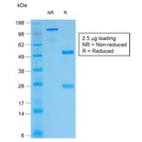 SDS-PAGE - Anti-Thyroglobulin Antibody [TGB/1968R] - BSA and Azide free (A253293) - Antibodies.com