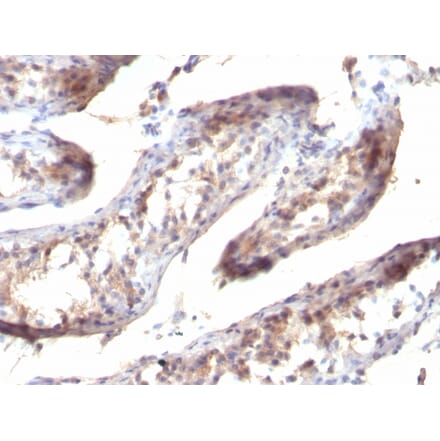 Immunohistochemistry - Anti-TGF alpha Antibody [SPM357] - BSA and Azide free (A253294) - Antibodies.com
