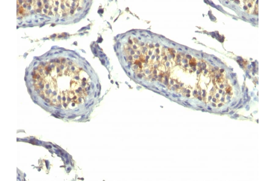 Immunohistochemistry - Anti-TGF alpha Antibody [P/T1] - BSA and Azide free (A253296) - Antibodies.com