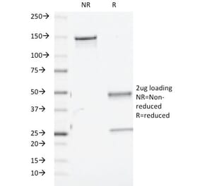 SDS-PAGE - Anti-TGF beta Antibody [TGFB/510] - BSA and Azide free (A253299) - Antibodies.com