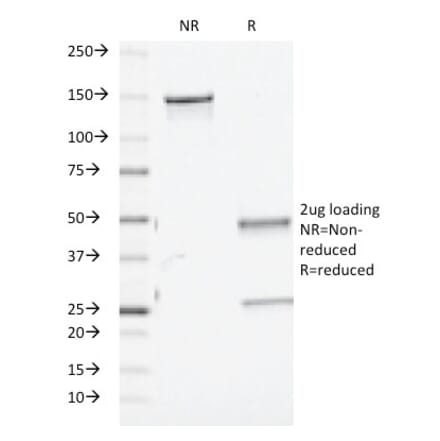 SDS-PAGE - Anti-TGF beta Antibody [TGFB/510] - BSA and Azide free (A253299) - Antibodies.com