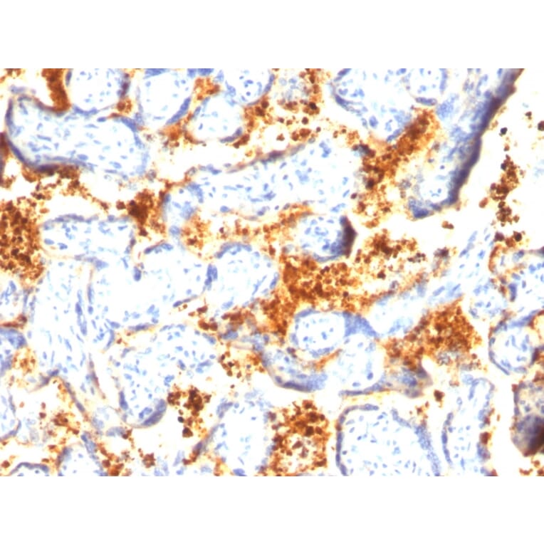 Immunohistochemistry - Anti-Transglutaminase II Antibody [SPM358] - BSA and Azide free (A253302) - Antibodies.com