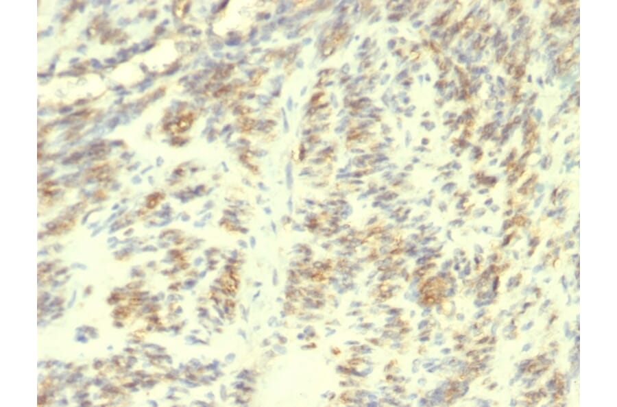 Immunohistochemistry - Anti-Transglutaminase II Antibody [SPM358] - BSA and Azide free (A253300) - Antibodies.com