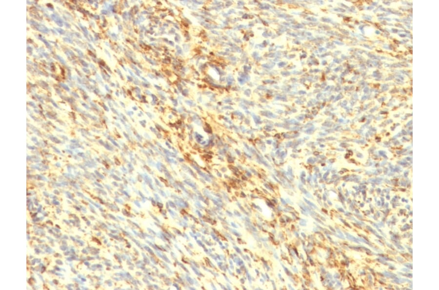 Immunohistochemistry - Anti-Transglutaminase II Antibody [SPM358] - BSA and Azide free (A253302) - Antibodies.com