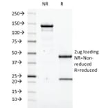 SDS-PAGE - Anti-Transglutaminase II Antibody [SPM358] - BSA and Azide free (A253302) - Antibodies.com
