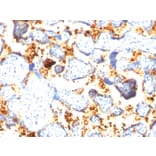 Immunohistochemistry - Anti-Transglutaminase II Antibody [SPM592] - BSA and Azide free (A253302) - Antibodies.com