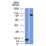 Western Blot - Anti-Thrombomodulin Antibody [THBD/1591] - BSA and Azide free (A253304) - Antibodies.com