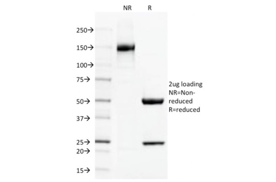 SDS-PAGE - Anti-Thrombomodulin Antibody [THBD/1591] - BSA and Azide free (A253304) - Antibodies.com