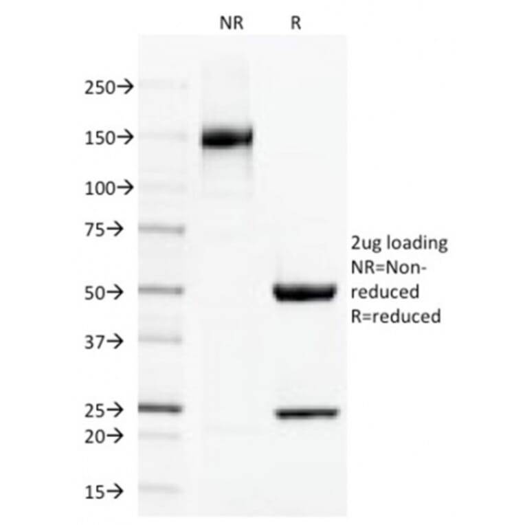SDS-PAGE - Anti-Thrombomodulin Antibody [THBD/1591] - BSA and Azide free (A253304) - Antibodies.com