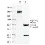 SDS-PAGE - Anti-Thrombomodulin Antibody [THBD/1591] - BSA and Azide free (A253304) - Antibodies.com